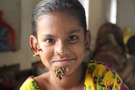  Орфанные заболевания у детей в России