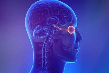  Глиома у детей