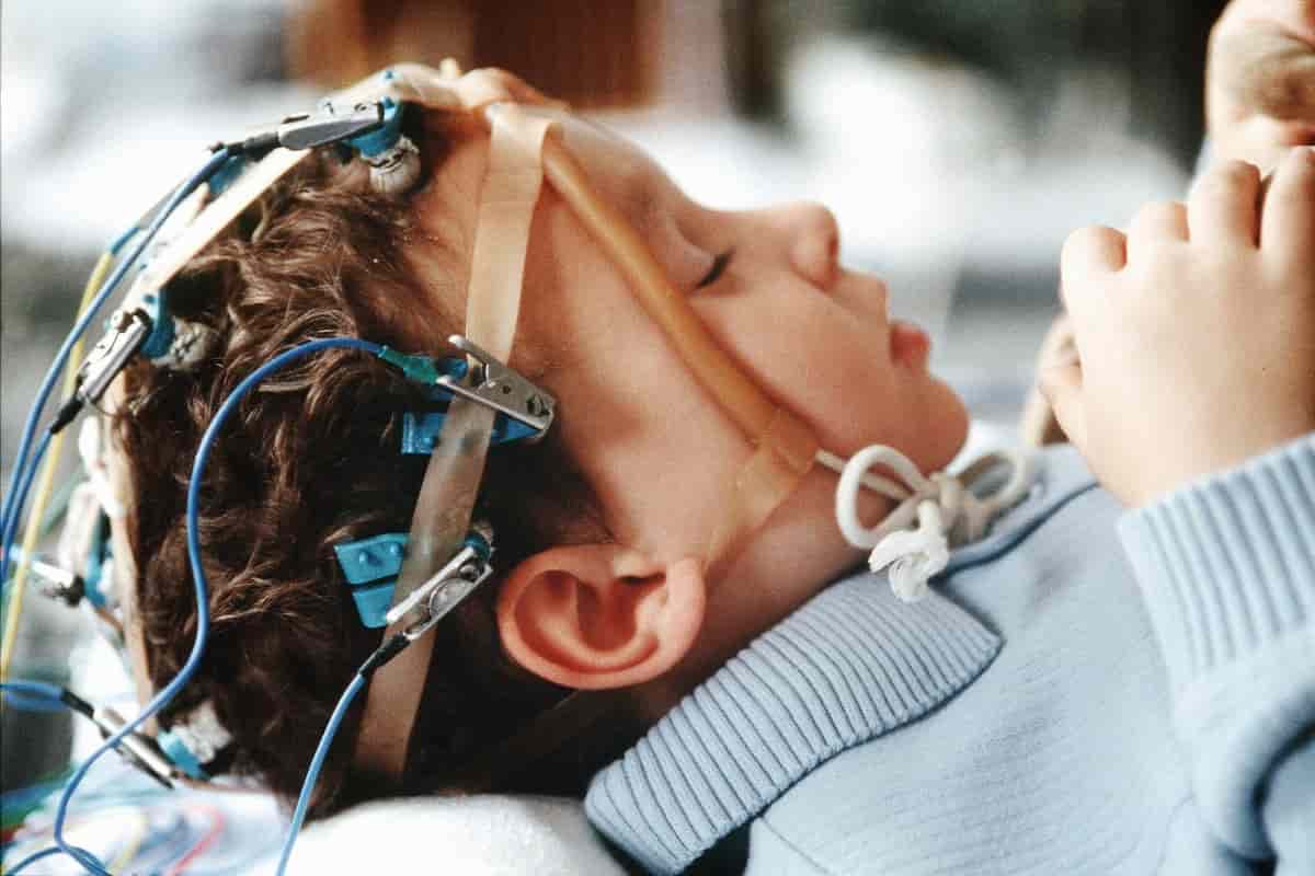 Эпилепсия: причины, симптомы, лечение