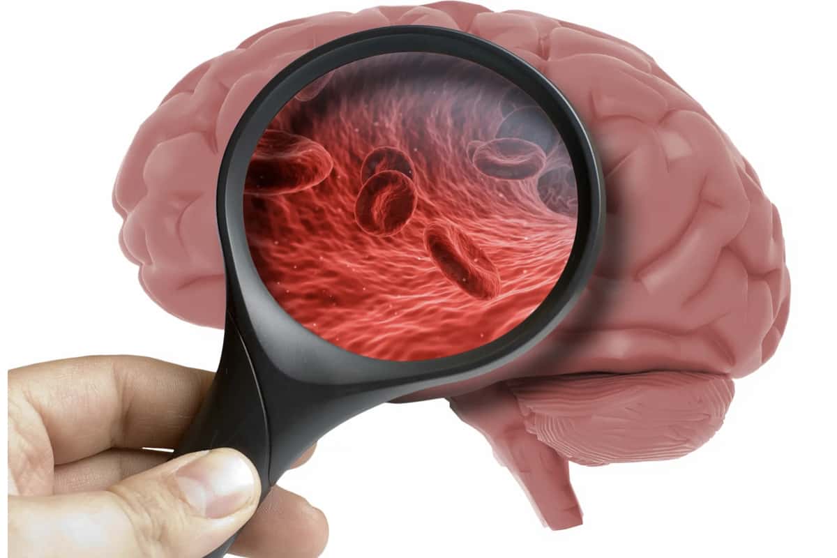 Энцефалопатия