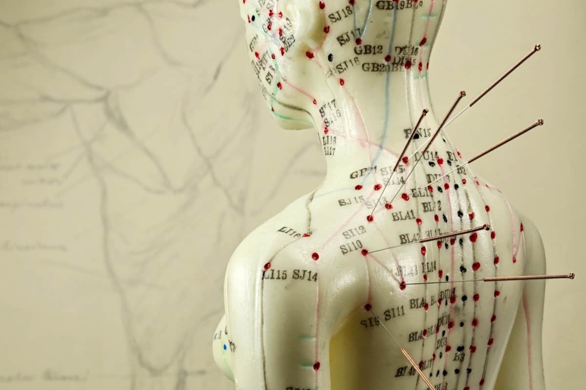 Иглорефлексотерапия