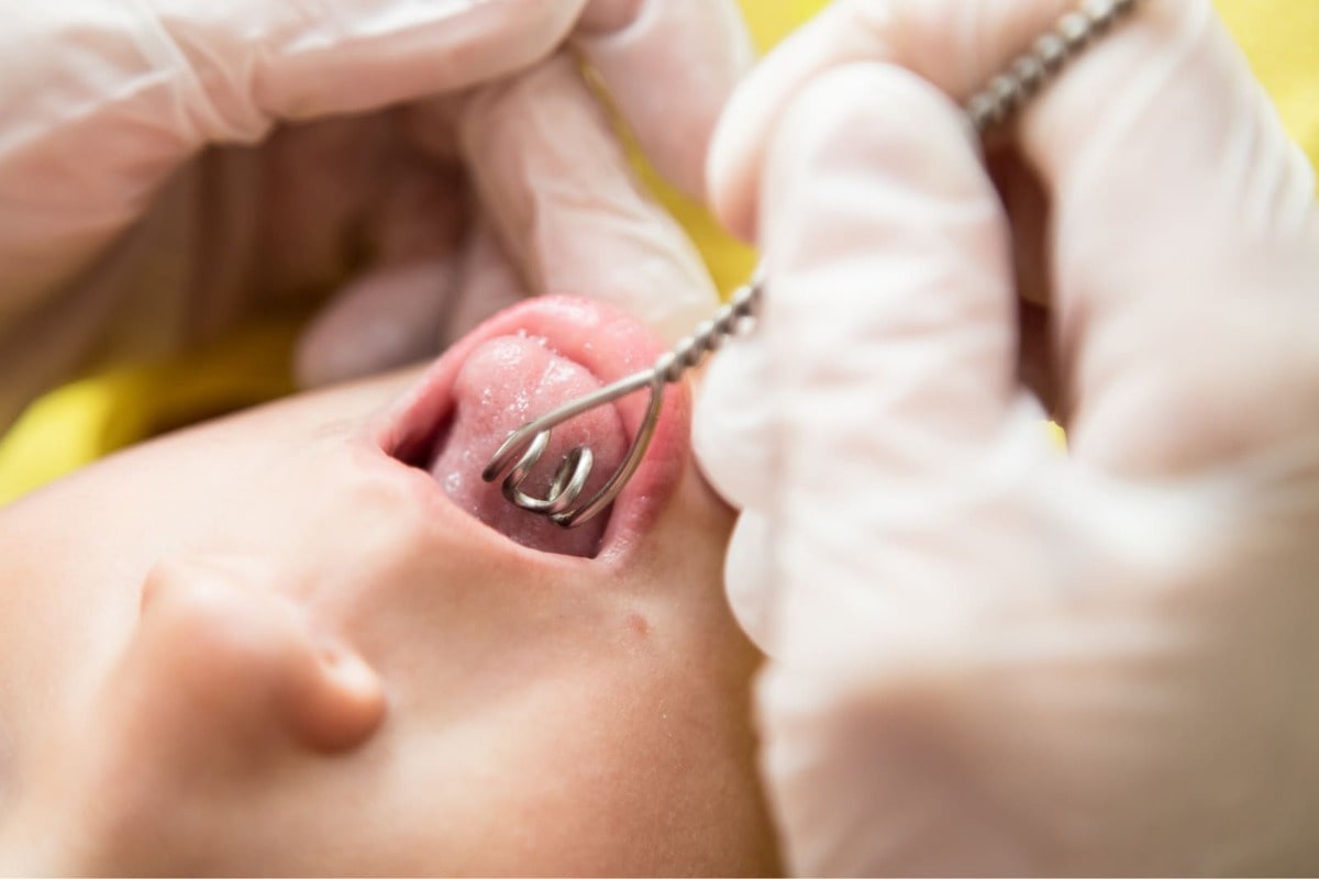 Логопедический массаж